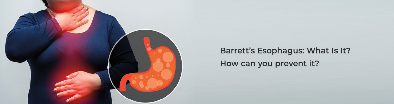 Barretts Esophagus: What Is It? How can you prevent it